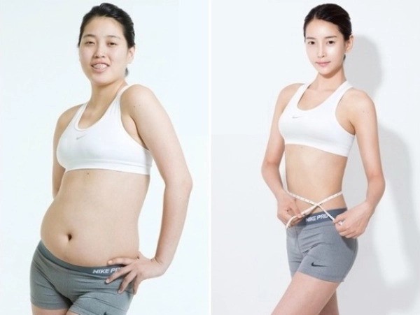 Việc sử dụng hóa chất để tiêm tan mỡ rất nguy hại cho cơ thể về lâu về dài như đau, sưng, đóng hòn tại khu phẫu thuật 