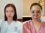 Làm đẹp - Không phải vì phong thủy, đây là 6 phương pháp "dao kéo" chị em nên tránh làm kẻo tiền mất tật mang