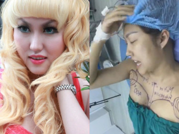 Nhan sắc từng bị chê biến dạng sau 21 lần dao kéo của Phi Thanh Vân giờ ra sao qua camera thường?