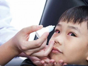 Đau mắt đỏ lây qua đường nào, nhỏ thuốc gì để mau khỏi? Riêng một loại thuốc nhỏ mắt cấm kỵ dùng