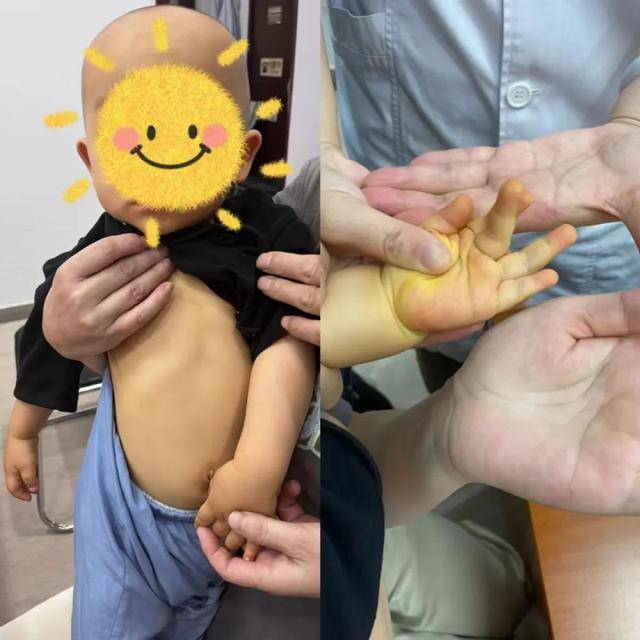 Con 10 tháng tuổi bị vàng da khắp cơ thể khiến bố mẹ chạy chữa đủ đường, hóa ra sai lầm từ cách ăn uống - 1
