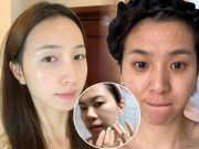 Người lười tẩy tế bào chết và người tẩy da chết thường xuyên, da ai lão hoá nhanh hơn? Câu trả lời gây bất ngờ