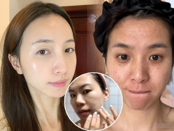 Người lười tẩy tế bào chết và người tẩy da chết thường xuyên, da ai lão hoá nhanh hơn? Câu trả lời gây bất ngờ