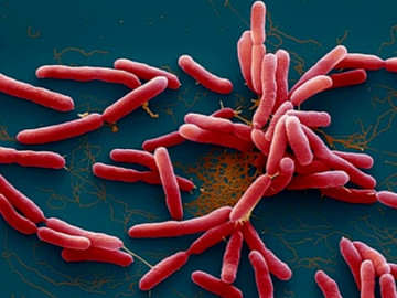 Thanh Hóa: Bệnh nhi 15 tuổi tử vong vì mắc bệnh Whitmore