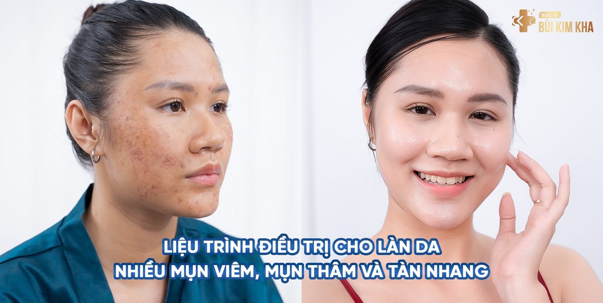 Bác sĩ thẩm mỹ Kim Kha giúp chị em duy trì vẻ xuân sắc của làn da  - 3