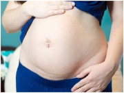Bà bầu - Bà mẹ liều mạng sinh mổ liên tục 7 lần, nhìn hình dáng hiện tại còn choáng váng hơn