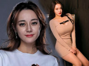 Làm đẹp - Phụ nữ có 3 nơi trên cơ thể chảy xệ này là dấu hiệu lão hóa, phải "bơm" ngay collagen