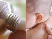 Yêu con - 4 tác hại nguy hiểm của Corticoid đối với làn da mỏng manh của trẻ mà mẹ không biết