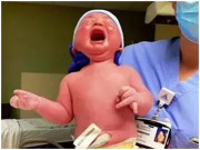 Bà bầu - Em bé chào đời với cân nặng siêu khủng khiến mẹ đau nhói giờ ra sao?