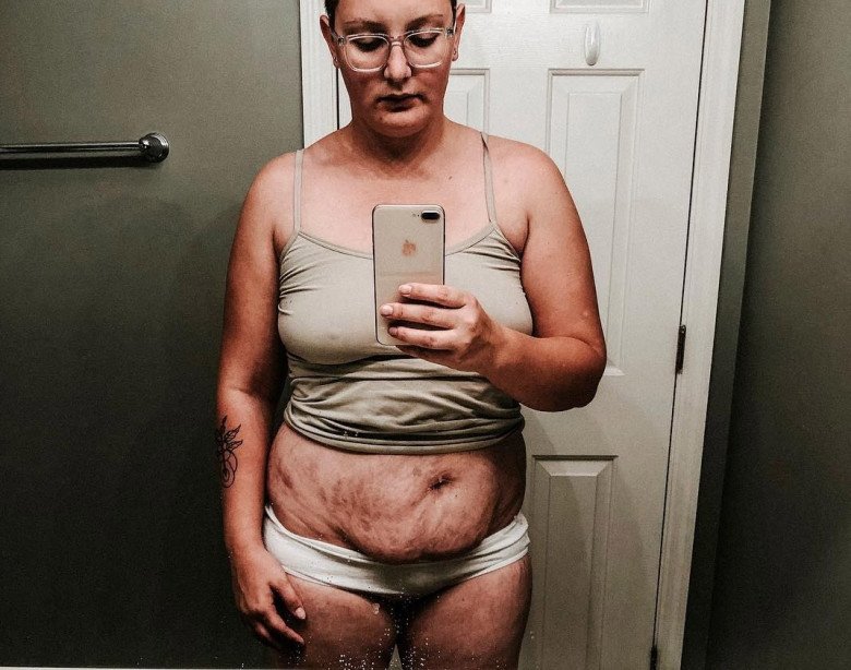 Người mẹ 4 con dũng cảm đăng hình ảnh chân thực của mình sau khi sinh.