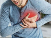 Sức khỏe - Người đàn ông đột ngột qua đời sau buổi tập thể dục, bác sĩ chỉ ra sai lầm nghiêm trọng nhiều người mắc