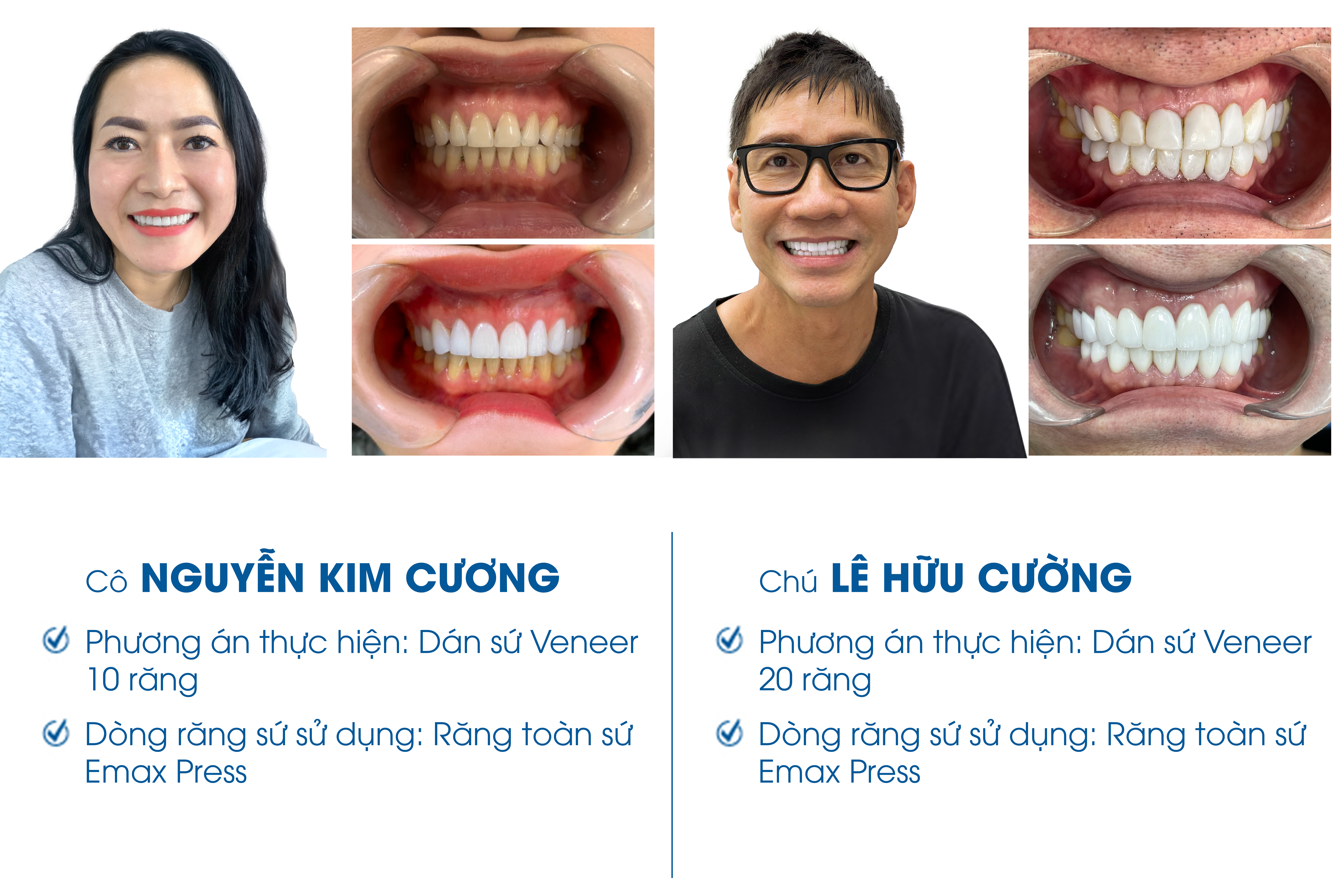 Khách hàng bọc răng sứ tại nha khoa I-Dent DiamondTech