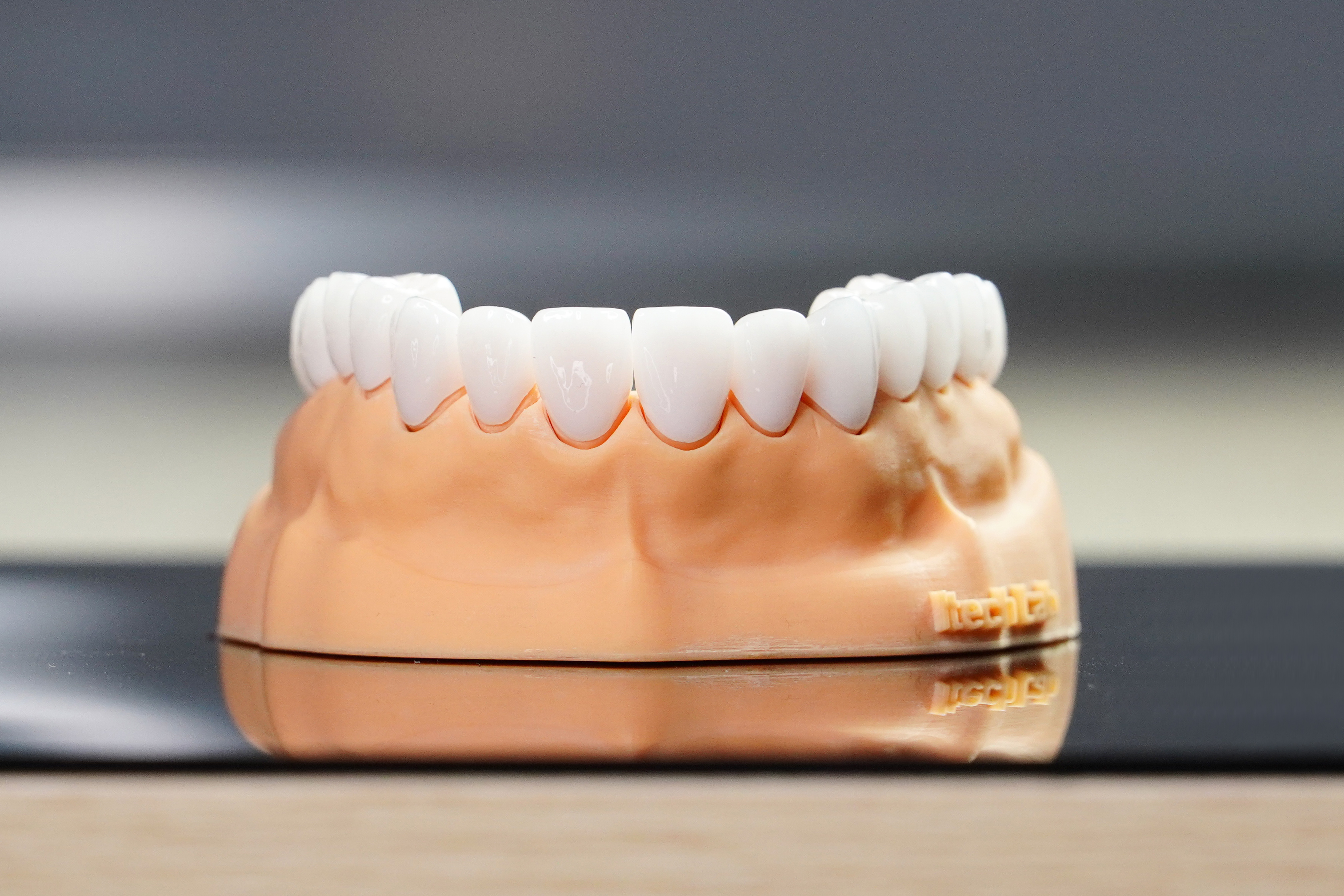 Mẫu răng sứ tại nha khoa I-Dent DiamondTech