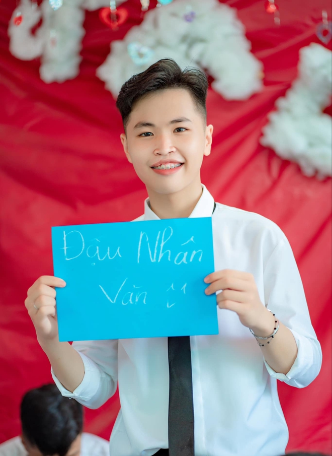Lộc bị dị tật hở hàm ếch, đã trải qua 3 lần phẫu thuật