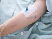 Sức khỏe - Bé trai 14 tuổi bất ngờ bị suy thận, mẹ thừa nhận con thường xuyên có thói quen này