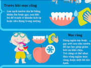Nuôi con IQ EQ - Infographic: Bảng chuẩn thứ tự và lịch mọc răng của trẻ sơ sinh - cách chăm sóc răng trẻ