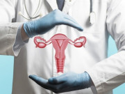 Sức khỏe - Loại ung thư này âm thầm tấn công ngày càng nhiều phụ nữ trẻ, dấu hiệu nhận biết dễ nhưng nhiều người bỏ qua