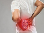 Sức khỏe - 5 thủ phạm làm thận càng ngày càng yếu, nhiều người không biết nên tự rước họa vào thân