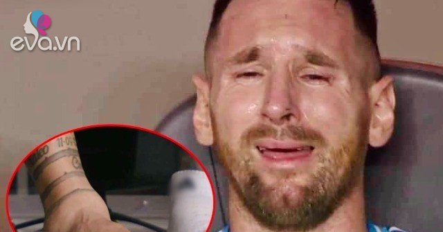 Cận cảnh cổ chân sưng vù của Messi khiến anh phải rời trận Chung kết ...