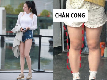 Tại sao không nên diện quần shorts hè này? Người sành mặc thích diện 3 kiểu quần dài gọt dáng này hơn