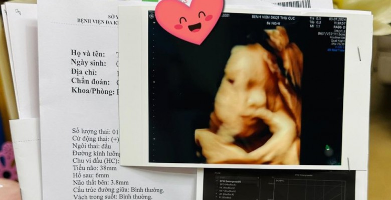 Sắp đến ngày “vượt cạnamp;#34;, vợ diễn viên Anh Tuấn chia sẻ thói quen đặc biệt của em bé trong bụng - 8