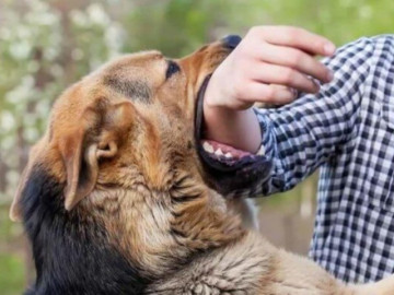 Chó nhà cắn vào ngón tay, tự điều trị khiến cả cánh tay nhiễm trùng nghiêm trọng