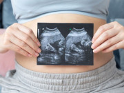 Bà bầu - Bà mẹ mang trong mình một "kỳ quan thế giới", có thai với hiện tượng cực kỳ hiếm gặp