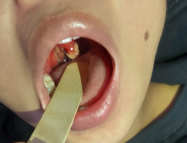 Bệnh nhân lấy mẫu xét nghiệm tại Bệnh viện Đa khoa tỉnh Thanh Hóa.