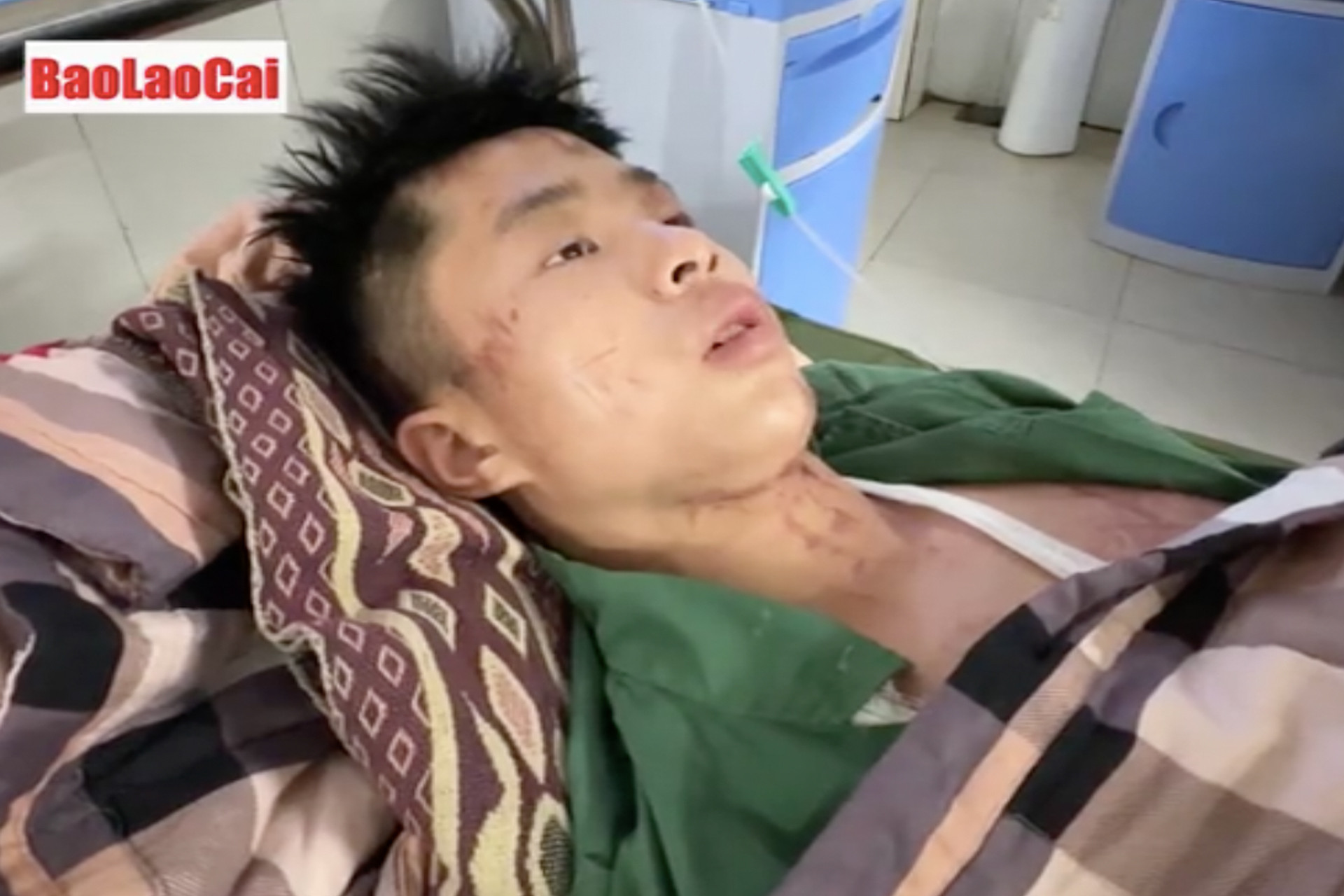 Anh Nguyễn Văn Hành đang điều trị tại Bệnh viện Đa khoa huyện Bảo Yên. Ảnh: Đức Toàn - Hữu Huỳnh/Báo Lào Cai 