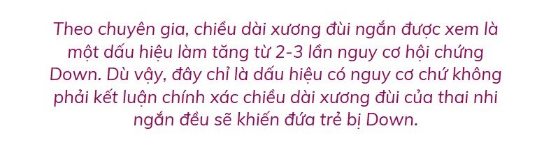 Chân con có dài như siêu mẫu hay không, mẹ cần biết rõ 4 yếu tố ảnh hưởng đến chiều dài xương đùi của thai nhi - 5