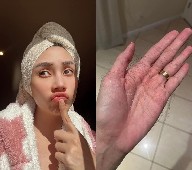 Siêu mẫu Võ Hoàng Yến amp;#34;tiết lộamp;#34; 3 vấn đề sức khỏe trong thai kỳ, mẹ bầu nào cũng thấy amp;#34;có mình trong đóamp;#34; - 11