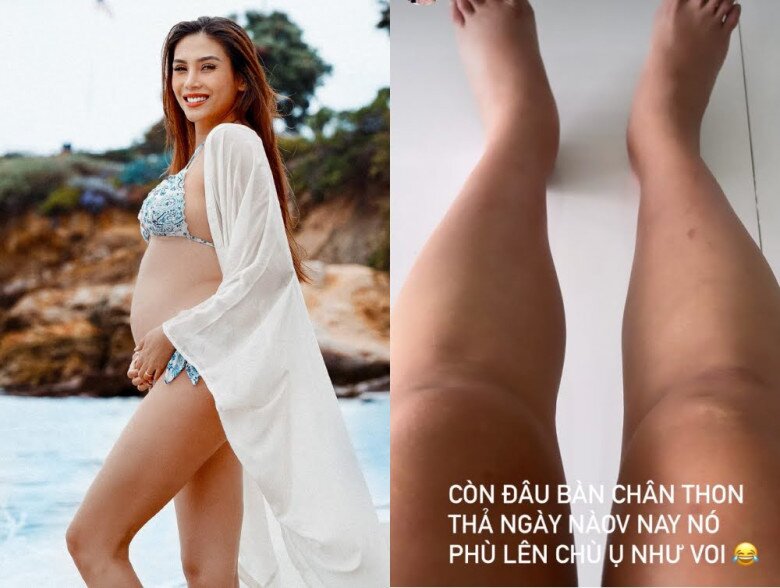 Siêu mẫu Võ Hoàng Yến amp;#34;tiết lộamp;#34; 3 vấn đề sức khỏe trong thai kỳ, mẹ bầu nào cũng thấy amp;#34;có mình trong đóamp;#34; - 3