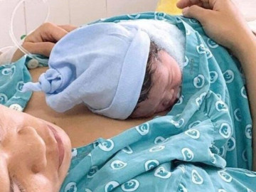 Cấp cứu thành công sản phụ đẻ rơi tại nhà