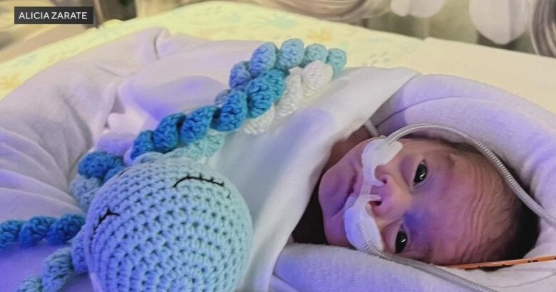 The baby boy was born weighing less than 500 grams.