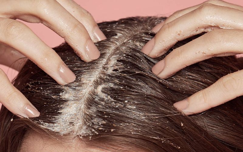 Combine exfoliation with a scalp massage for better results and relaxation.