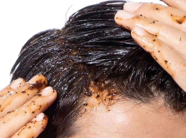 Image of scalp exfoliation