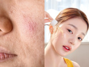 Làm đẹp - 7 thói quen chăm sóc da khiến lỗ chân lông mở “toang hoác”, có đi thẩm mỹ viện cũng khó cứu được