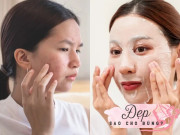 Đẹp - 7 thói quen chăm sóc da tưởng tốt nhưng khiến chị em nhanh lão hóa, chưa già đã có nếp nhăn, da dẻ xám xịt