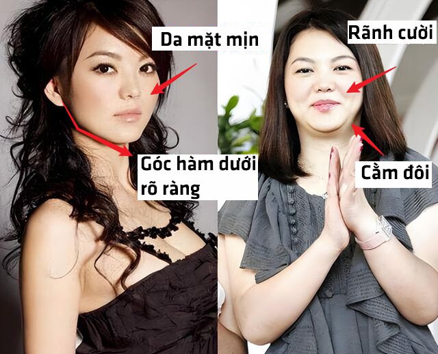 Sự tăng cân đã phá vỡ những ưu điểm trên khuôn mặt Li Xiang.