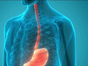 Clip Eva - Báo động trẻ hóa ung thư đường tiêu hóa, khi nào cần khám tầm soát?