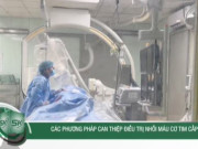 Clip Eva - Các phương pháp can thiệp điều trị nhồi máu cơ tim cấp