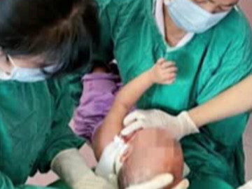 Thầy lang bôi mỡ trăn chữa bỏng canh khiến bé gái nguy kịch