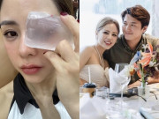 Giải trí - Bạch Lan Phương vợ Huỳnh Anh bầm tím mặt vì chơi pickleball, tiết lộ tay chân sứt sẹo, xước cả mũi