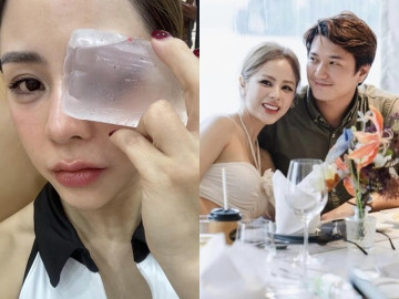 Bạch Lan Phương vợ Huỳnh Anh bầm tím mặt vì chơi pickleball, tiết lộ tay chân sứt sẹo, xước cả mũi