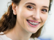 Lifestyle - Những vật dụng bất ly thân của hội niềng răng, món cuối chỉ 5.000 đồng nhưng mang hiệu quả đỉnh cao