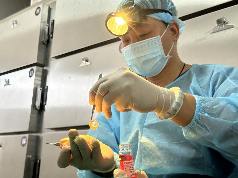 Kỹ thuật viên Đức Anh thực hiện lấy giác mạc thành công từ người hiến tặng. Ảnh: BVCC.