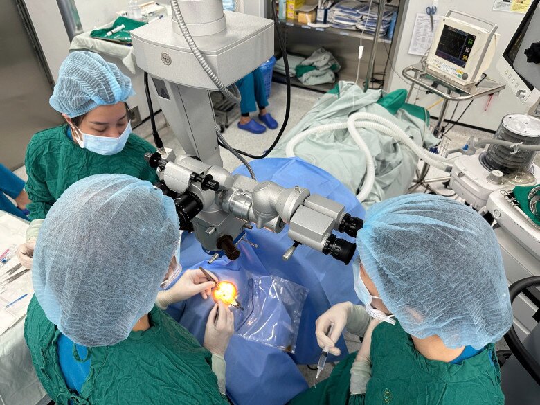 Ca ghép giác mạc cho người phụ nữ bị loạn dưỡng giác mạc diễn ra trong vòng 45 phút. Ảnh: BSCC.