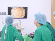 Sức khỏe - Người đàn ông khỏe mạnh ở Hà Nội bỗng phát hiện mầm ung thư nhờ làm một việc, bác sĩ hết lời ngợi khen