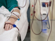 Sức khỏe - Nhà 3 đời bị mỡ máu cao, tôi có nên lọc máu để phòng bệnh? Câu trả lời của bác sĩ khiến nhiều người giật mình