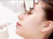 Người phụ nữ 44 tuổi suýt trả giá đắt sau khi đi làm đẹp tại cơ sở thẩm mỹ chui